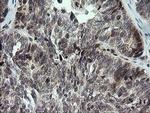 KIF25 Antibody in Immunohistochemistry (Paraffin) (IHC (P))