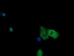 NR1 Antibody in Immunocytochemistry (ICC/IF)