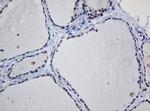 TRMT2A Antibody in Immunohistochemistry (Paraffin) (IHC (P))