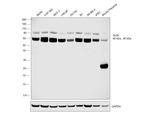 GLB1 Antibody in Western Blot (WB)