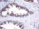 GLB1 Antibody in Immunohistochemistry (Paraffin) (IHC (P))