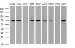 GLB1 Antibody in Western Blot (WB)