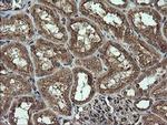 DIXDC1 Antibody in Immunohistochemistry (Paraffin) (IHC (P))