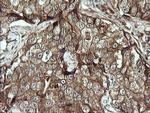 DIXDC1 Antibody in Immunohistochemistry (Paraffin) (IHC (P))