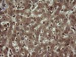 DIXDC1 Antibody in Immunohistochemistry (Paraffin) (IHC (P))