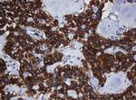 TAPBPL Antibody in Immunohistochemistry (Paraffin) (IHC (P))