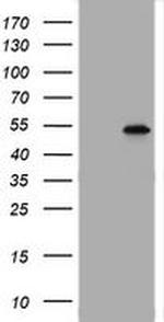 TAPBPL Antibody in Western Blot (WB)