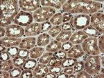 TRMT2A Antibody in Immunohistochemistry (Paraffin) (IHC (P))