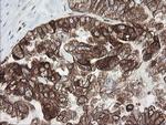 TAPBPL Antibody in Immunohistochemistry (Paraffin) (IHC (P))