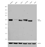 GLB1 Antibody in Western Blot (WB)