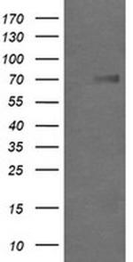 GLB1 Antibody in Western Blot (WB)