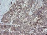 TRAPPC4 Antibody in Immunohistochemistry (Paraffin) (IHC (P))