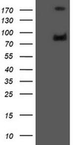 GLB1 Antibody in Western Blot (WB)