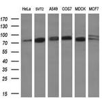 GLB1 Antibody in Western Blot (WB)