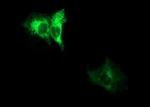 ADAMTS8 Antibody in Immunocytochemistry (ICC/IF)