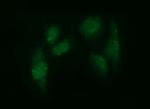 ADAMTS8 Antibody in Immunocytochemistry (ICC/IF)