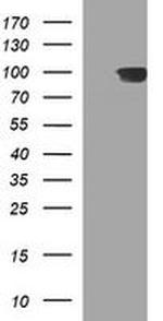 ADAMTS8 Antibody in Western Blot (WB)