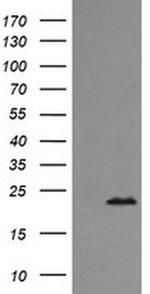 RAB24 Antibody in Western Blot (WB)