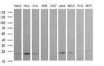 RAB24 Antibody in Western Blot (WB)