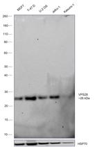 VPS28 Antibody in Western Blot (WB)
