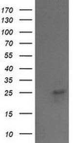 VPS28 Antibody in Western Blot (WB)