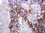 PARVB Antibody in Immunohistochemistry (Paraffin) (IHC (P))