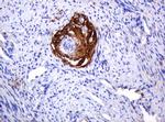 PARVB Antibody in Immunohistochemistry (Paraffin) (IHC (P))