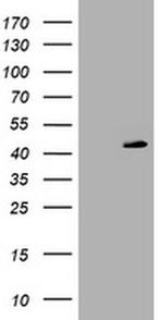 PARVB Antibody in Western Blot (WB)