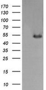 MDMX Antibody in Western Blot (WB)