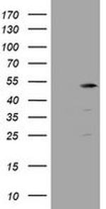 TBC1D13 Antibody in Western Blot (WB)