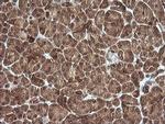 PIK3R5 Antibody in Immunohistochemistry (Paraffin) (IHC (P))