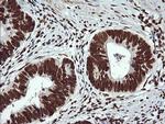 THUMPD1 Antibody in Immunohistochemistry (Paraffin) (IHC (P))