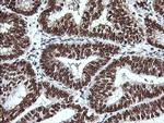 THUMPD1 Antibody in Immunohistochemistry (Paraffin) (IHC (P))