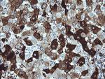 DPCD Antibody in Immunohistochemistry (Paraffin) (IHC (P))