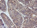 TRIM38 Antibody in Immunohistochemistry (Paraffin) (IHC (P))