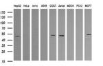 TRIM38 Antibody in Western Blot (WB)