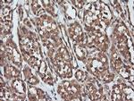 PARVA Antibody in Immunohistochemistry (Paraffin) (IHC (P))