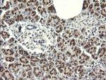 IL1F9 Antibody in Immunohistochemistry (Paraffin) (IHC (P))