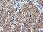 IL1F9 Antibody in Immunohistochemistry (Paraffin) (IHC (P))