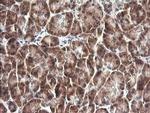 IL1F9 Antibody in Immunohistochemistry (Paraffin) (IHC (P))