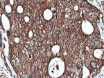 PIK3C2B Antibody in Immunohistochemistry (Paraffin) (IHC (P))