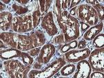 PIK3C2B Antibody in Immunohistochemistry (Paraffin) (IHC (P))