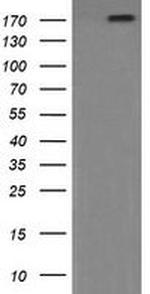 PIK3C2B Antibody in Western Blot (WB)