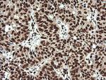 SAE1 Antibody in Immunohistochemistry (Paraffin) (IHC (P))