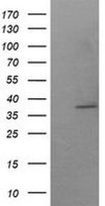 SAE1 Antibody in Western Blot (WB)