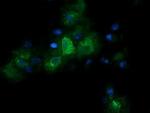 RARRES1 Antibody in Immunocytochemistry (ICC/IF)