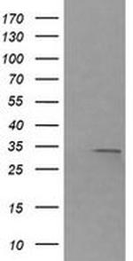 RARRES1 Antibody in Western Blot (WB)