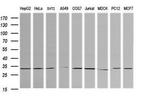 RARRES1 Antibody in Western Blot (WB)