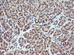 RARRES1 Antibody in Immunohistochemistry (Paraffin) (IHC (P))