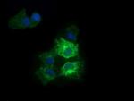 RARRES1 Antibody in Immunocytochemistry (ICC/IF)